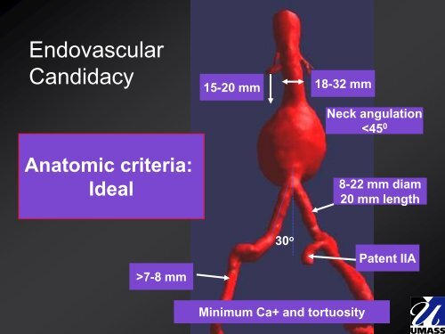 EVAR Instructions for Use (IFU): What They Mean ... - VascularWeb