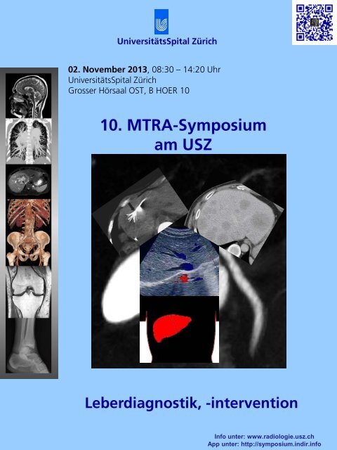 10. MTRA-Symposium am USZ - Radiologie - UniversitÃ¤tsSpital ZÃ¼rich