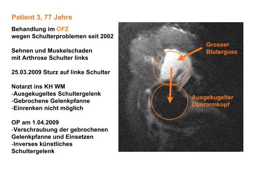 das PDF des Vortrags downloaden - OrthopÃ¤disches Fachzentrum ...