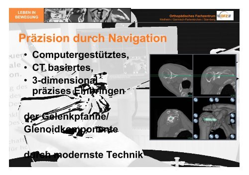 das PDF des Vortrags downloaden - OrthopÃ¤disches Fachzentrum ...