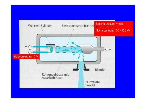 Aufbau einer RÃ¶ntgeneinrichtung unter besonderer ... - Radiologie