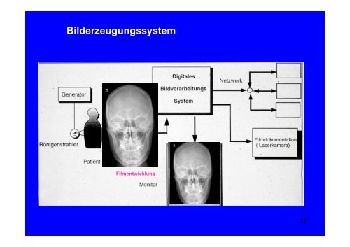 Aufbau einer RÃ¶ntgeneinrichtung unter besonderer ... - Radiologie