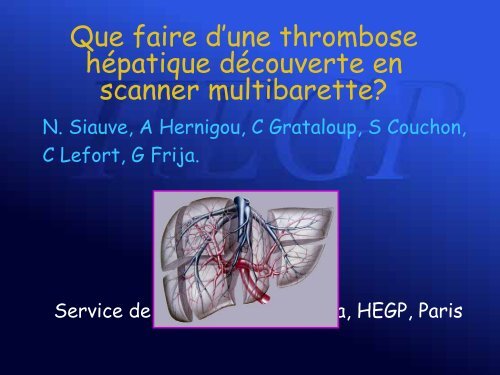 Que faire d'une thrombose hÃ©patique dÃ©couverte en scanner ...