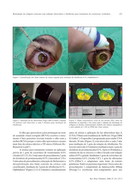 Set-Out - Sociedade Brasileira de Oftalmologia