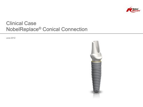 Clinical case nobelreplace conical connection - Nobel Biocare