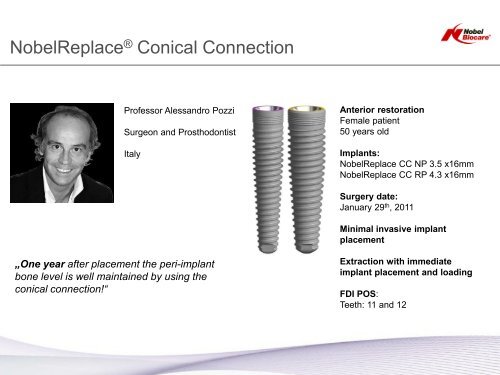 Clinical case nobelreplace conical connection - Nobel Biocare