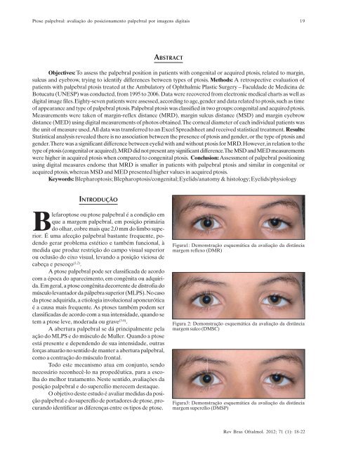 Jan-Fev - Sociedade Brasileira de Oftalmologia