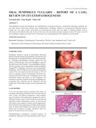 oral pemphigus vulgaris â report of a case; review on its ... - Aosr.co.in
