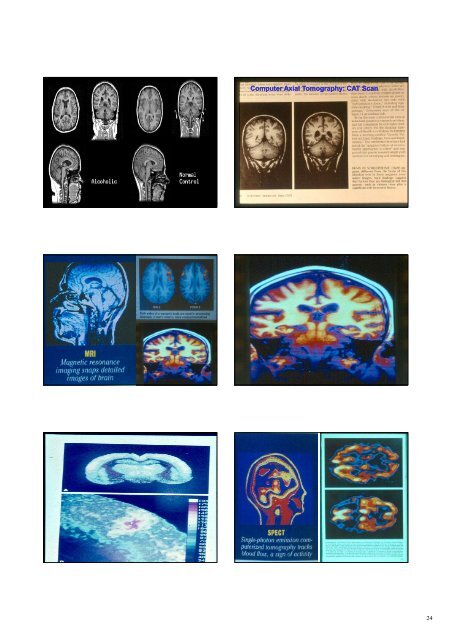 Triune Brain - Neuroscience.mahidol.ac.th - Mahidol University