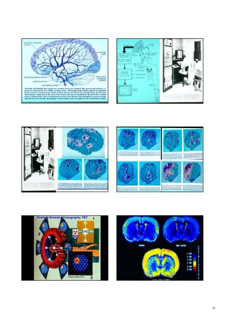 Triune Brain - Neuroscience.mahidol.ac.th - Mahidol University