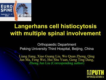 Langerhans cell histiocytosis with multiple spinal involvement