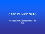 Inestabilidad mediocarpiana en DISI