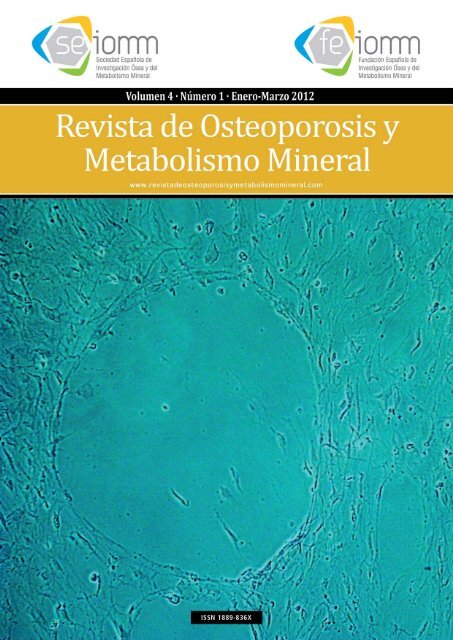 NÂº 1 EspaÃ±ol - Revista de Osteoporosis y Metabolismo Mineral