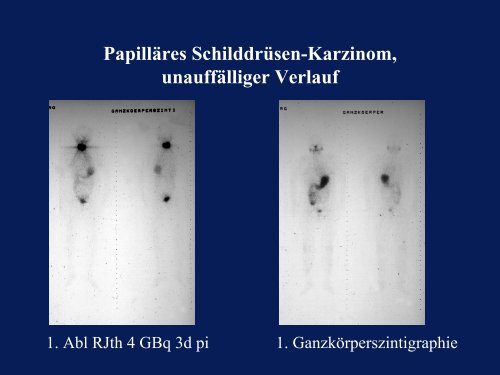 SD-Szintigraphie