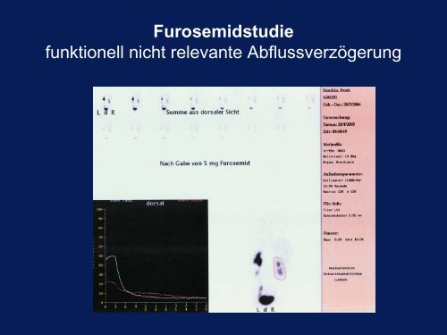 SD-Szintigraphie