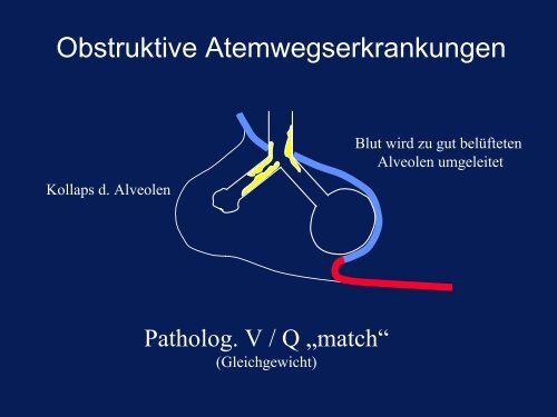 SD-Szintigraphie