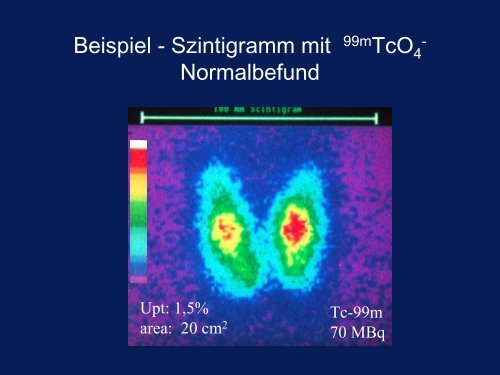 SD-Szintigraphie