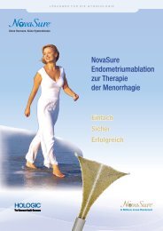 NovaSure Endometriumablation zur Therapie der Menorrhagie