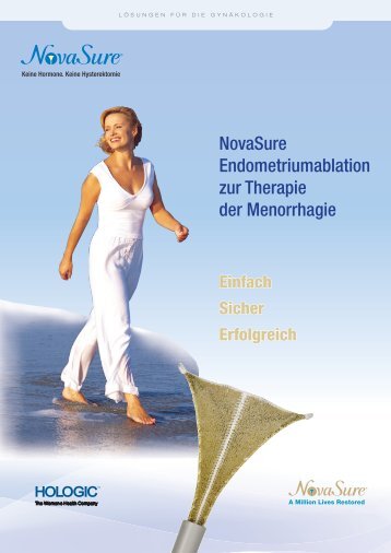 NovaSure Endometriumablation zur Therapie der Menorrhagie