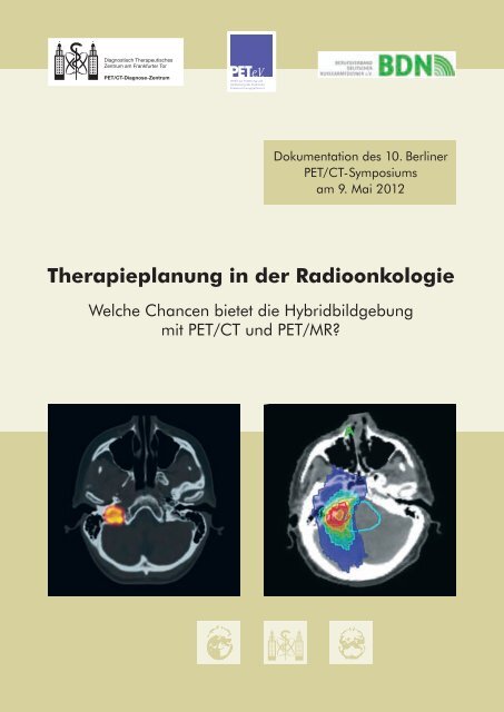 Therapieplanung in der Radioonkologie - DTZ Berlin