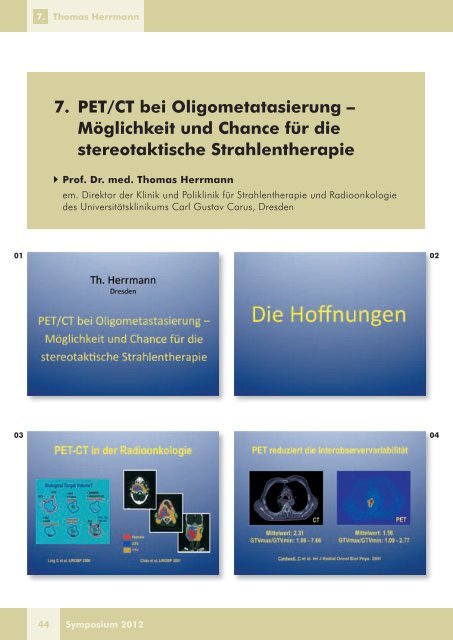 Therapieplanung in der Radioonkologie - DTZ Berlin