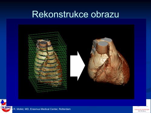 Mohou novÃ© neinvazivnÃ­ metody nahradit koronarografii