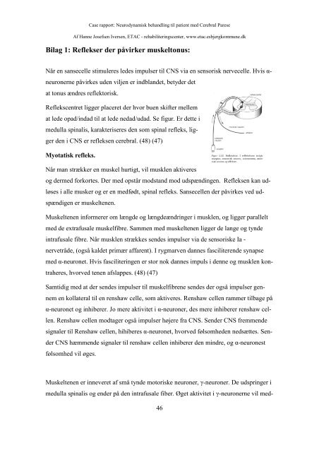 Neurodynamisk behandling til patient med cerebral parese