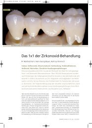 Das 1x1 der Zirkonoxid-Behandlung - Arbeitsgemeinschaft Keramik