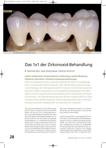 Das 1x1 der Zirkonoxid-Behandlung - Arbeitsgemeinschaft Keramik