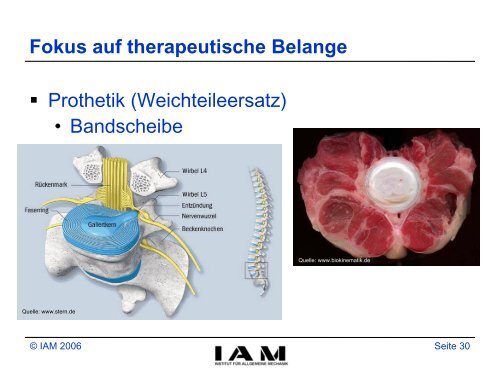 Zur Mechanik des menschlichen Bewegungsapparates - Institut fÃ¼r ...