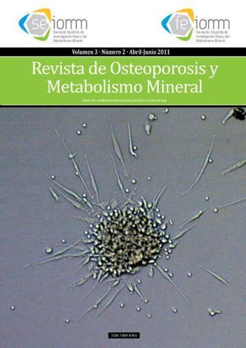 NÂº 2 EspaÃ±ol - Revista de Osteoporosis y Metabolismo Mineral