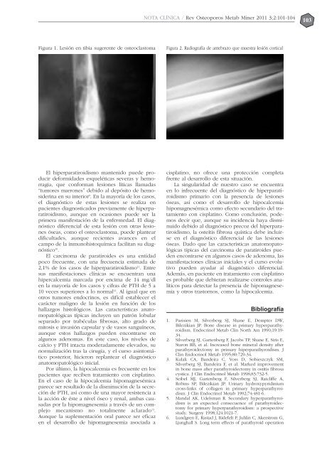 NÂº 2 EspaÃ±ol - Revista de Osteoporosis y Metabolismo Mineral