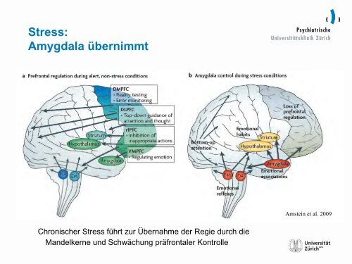 Umgang mit Stress – was zeigt uns das Gehirn