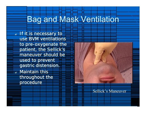 2009 RSI & Difficult Airway Review for website.ppt ... - Vbems.com