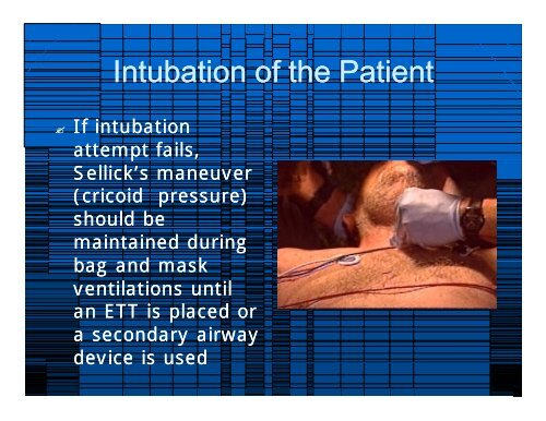 2009 RSI & Difficult Airway Review for website.ppt ... - Vbems.com