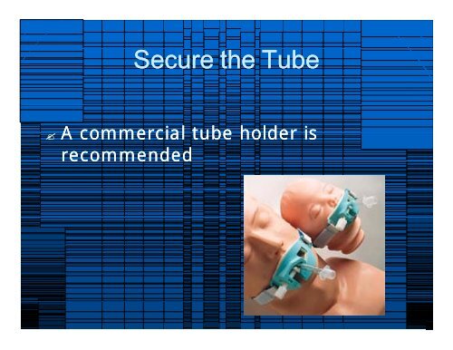 2009 RSI & Difficult Airway Review for website.ppt ... - Vbems.com