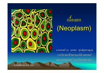 เนื้องอก (Neoplasm) - มหาวิทยาลัยนเรศวร