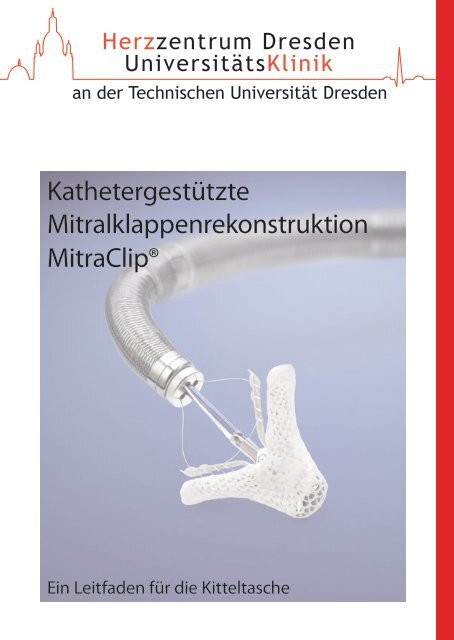 Mitraclip Heft - Kardiologie Dresden