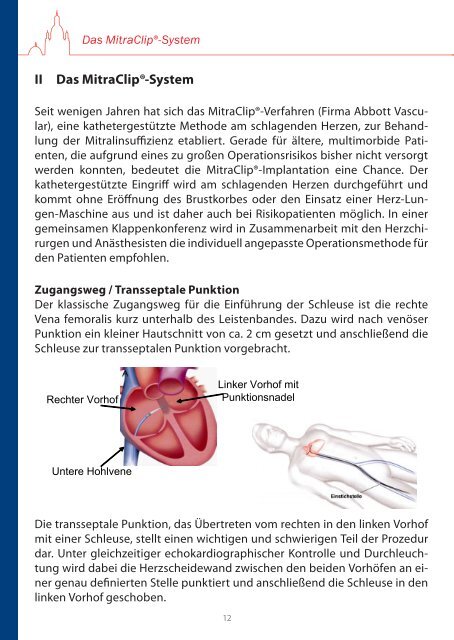 Mitraclip Heft - Kardiologie Dresden