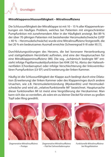 Mitraclip Heft - Kardiologie Dresden