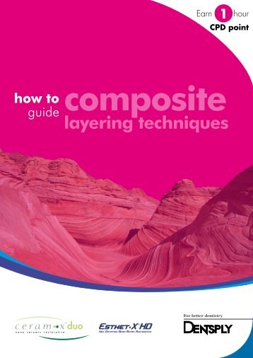 Composite & layering techniques - Dentsply