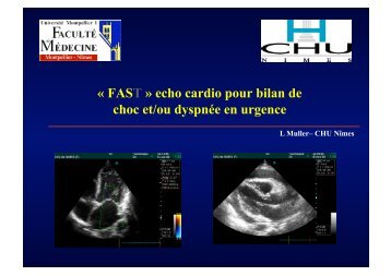 « FAST » echo cardio pour bilan de choc et/ou ... - SMUR BMPM