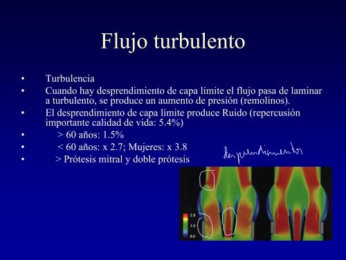 Aplicaciones de la Mecánica de fluidos a la cirugía cardio vascular