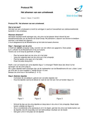 P6 Afnemen van een urinekweek - Diagnostisch centrum SSDZ ...