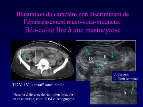 (je l'espÃ¨re) LUDIQUE Ã L'ÃCHOGRAPHIE DU TUBE DIGESTIF