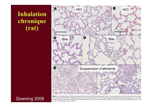 Diagnostic des pathologies d'inhalation - SociÃ©tÃ© pÃ©diatrique de ...