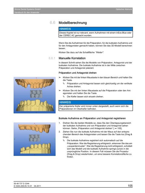 CEREC 3D