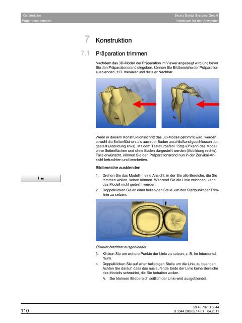 CEREC 3D