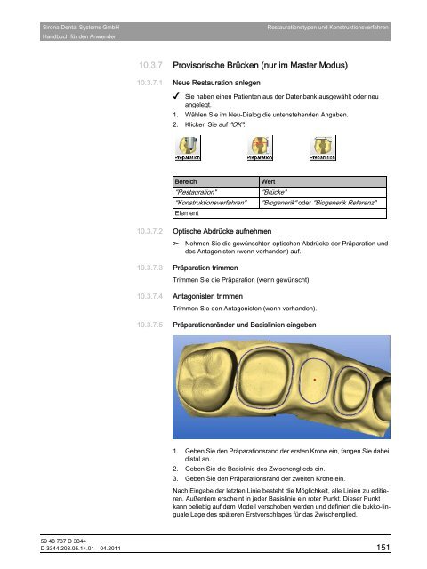 CEREC 3D