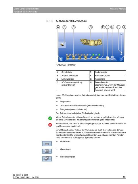 CEREC 3D